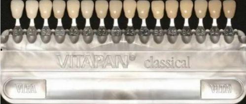 牙贴面视频,瞬间焕新笑容的秘密武器