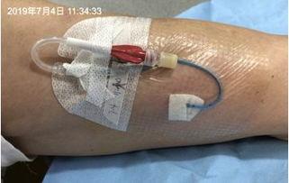 picc护理视频,PICC护理操作要点及技巧解析